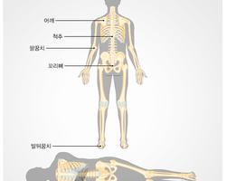 욕창 예방과 간호(1) - 와상 어르신 욕창 예방 체위 