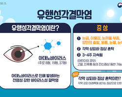덥고 습한 여름철, 유행성 눈병 주의, 유행성 눈병을 조심하세요!(유행성각결막염, 아폴로눈
