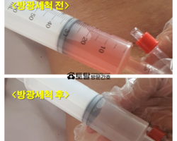 배뇨장애의 원인, 요로결석