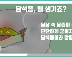 기름진 음식을 많이 먹으면 ‘담석증’에 걸릴 확률이 높다?