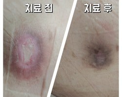 장기침상안정상태 어르신, 에어매트리스 유지의 중요성