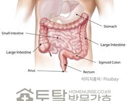 증상 없이 나타나 서서히 커져가는 침묵의 대장암