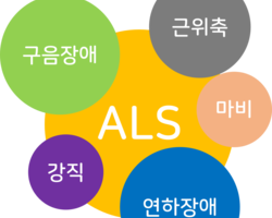 신경퇴화질환 - 근위축성측삭경화증