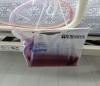 보라색소변 (PUBS:Purple Urine Bag Syndrome)